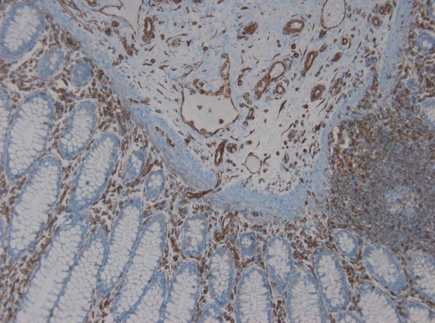 Figure 2. Immunohistochemistry with RV203 on paraffin section of human colon.